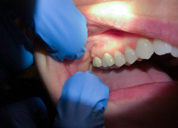 Best Pediatric Emergency Dentist in Monmouth Beach, NJ