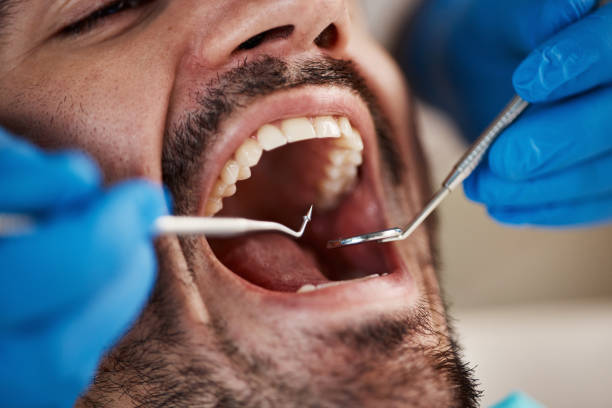 Best Broken or Cracked Tooth Emergency Dentist in Monmouth Beach, NJ